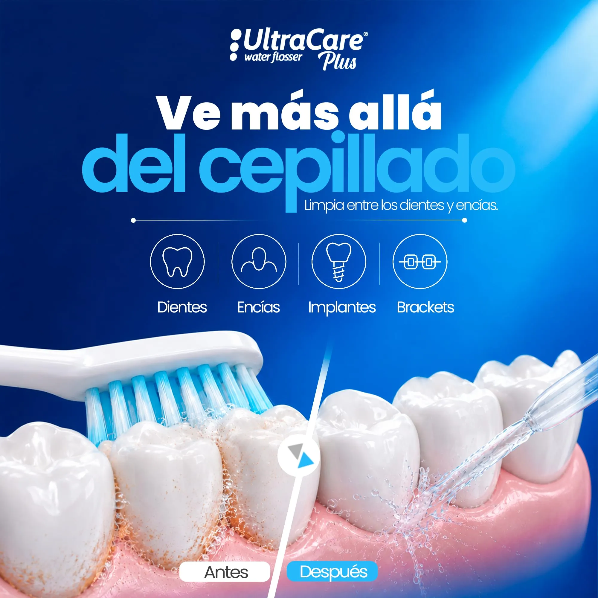 Boston Tech Aquapik UltraCare Irrigatore Orale Wireless, Idropulsore Dentale Portatile USB-C, 8 Ugelli, Serbatoio 300 ml, IPX7 - immagine 2