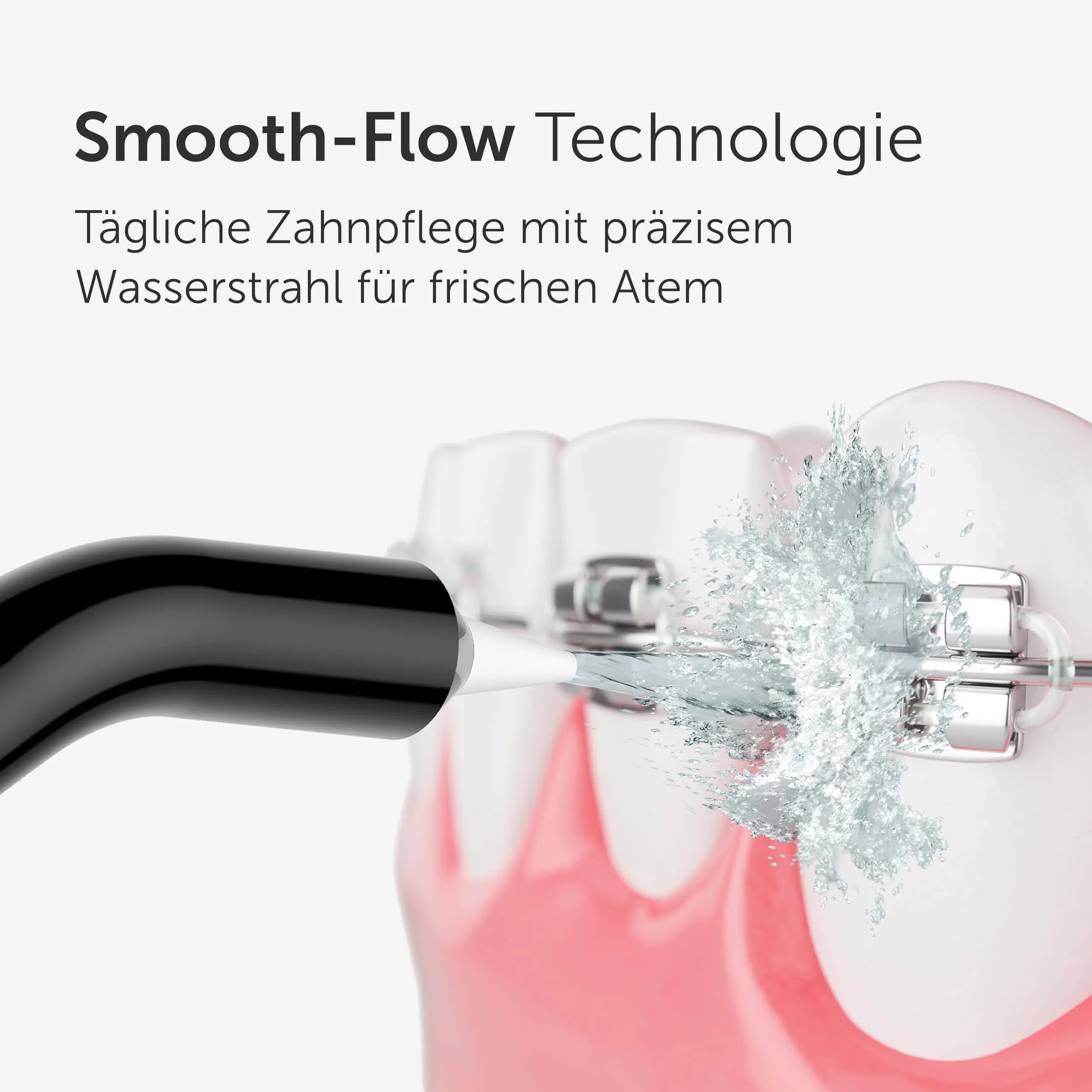 WonderSmile Ugello periodontale per irrigatore orale Waterflow, Tecnologia SmoothFlow, Nero, confezione da 4 - immagine 3