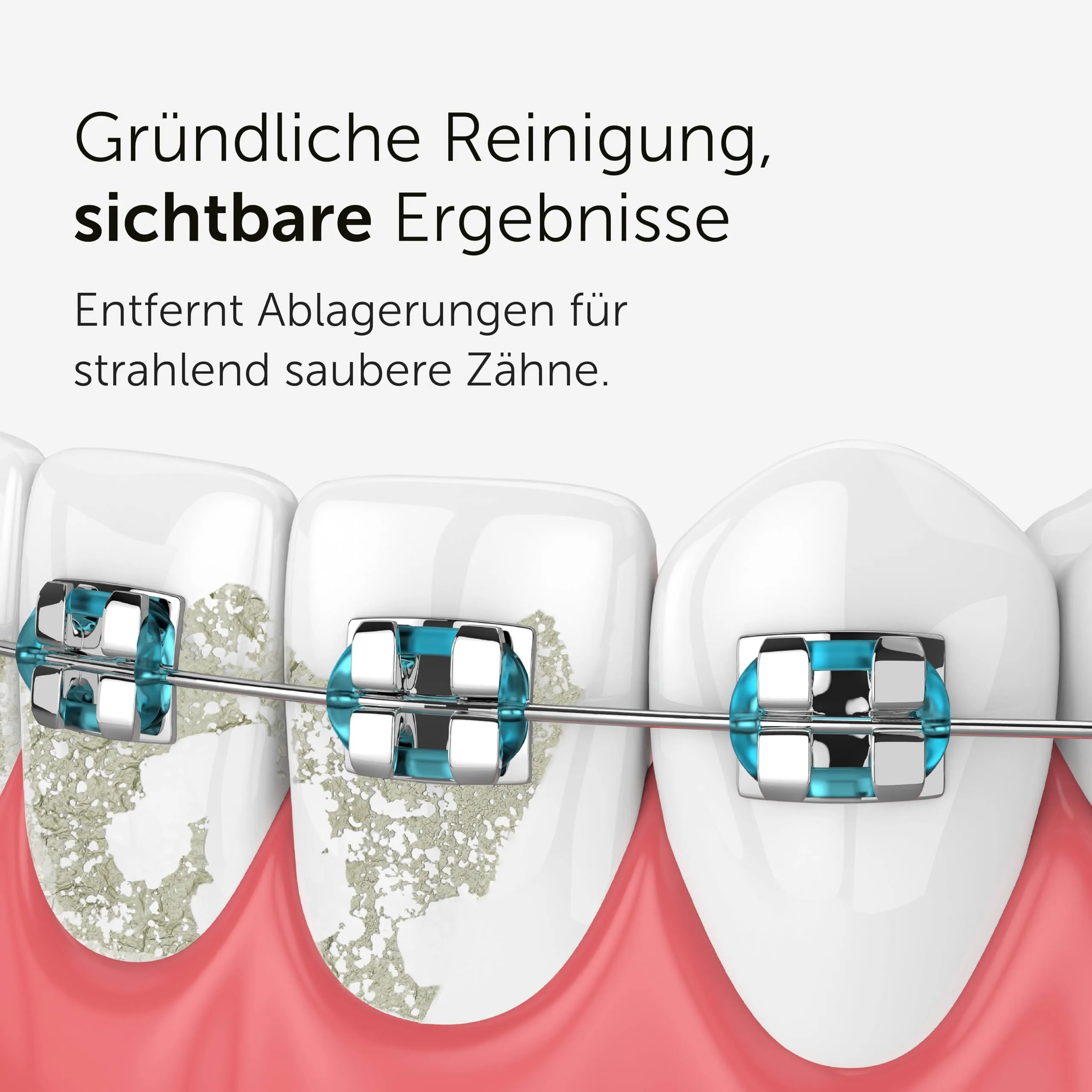 WonderSmile Ugelli di ricambio ortodontici per irrigatore orale Waterflow, Bianco, Confezione da 4 - immagine 4