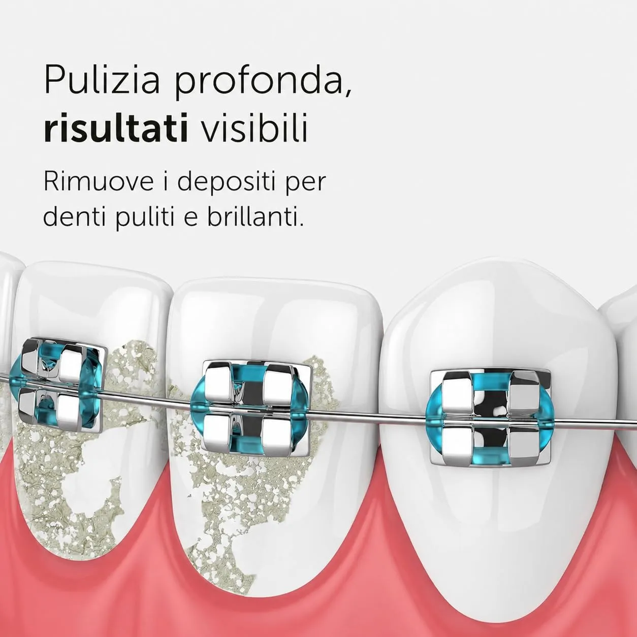 WonderSmile Ugelli di ricambio per irrigatore orale Waterflow, Tecnologia SmoothFlow, Nero, Confezione da 4 - immagine 3