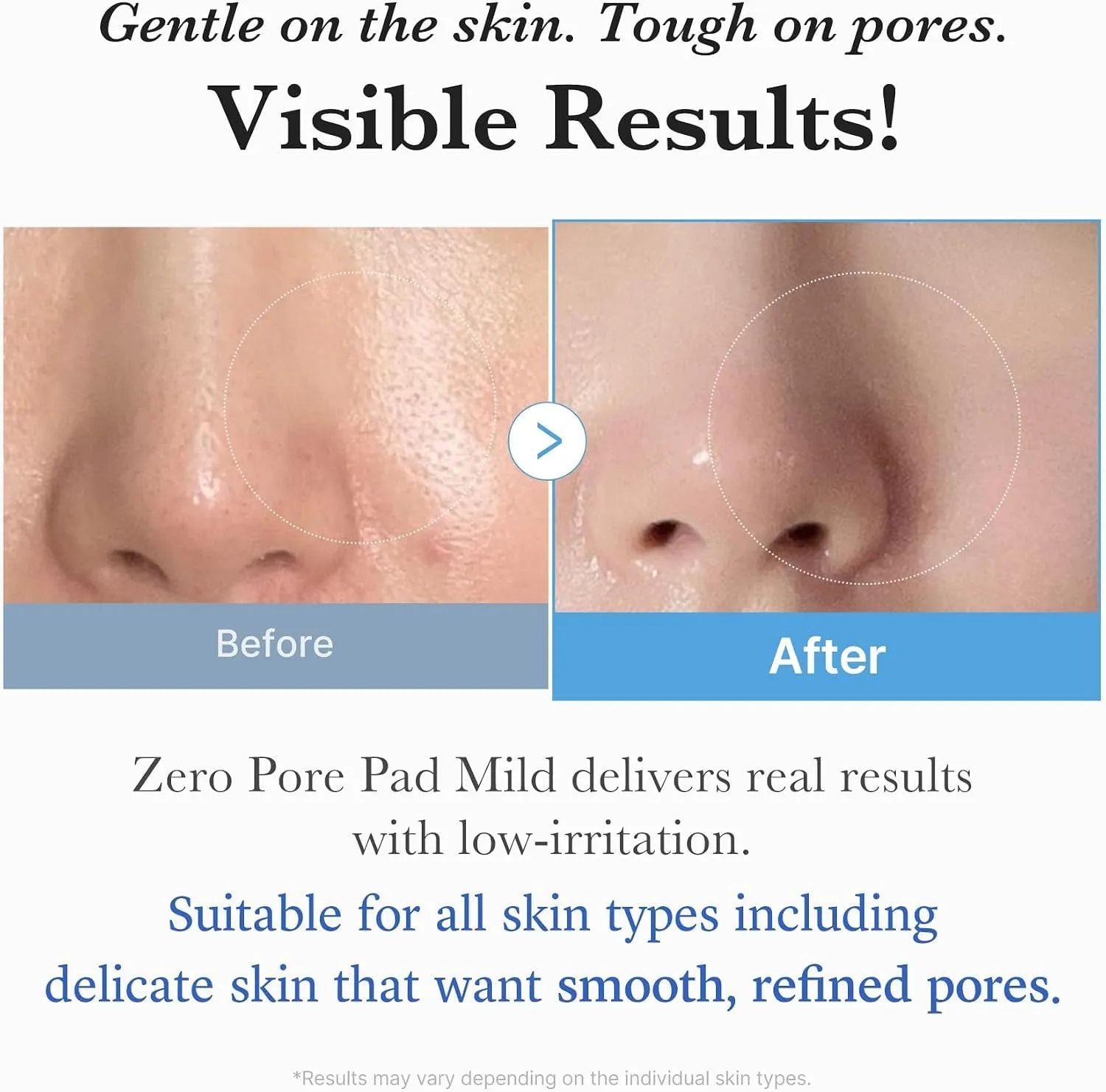medicube Zero Pore Pad Mild 2.0 Toner Pads, 70 Pads - immagine 5