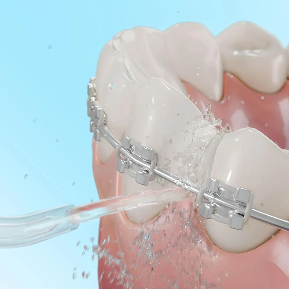 Cecotec ToothCare 1200 Jet Pro Oral Irrigator, 7 Nozzles, LED Display, 1000 ml Capacity, 10 Pressure Settings, IPX4, UV Light Disinfection - immagine 4