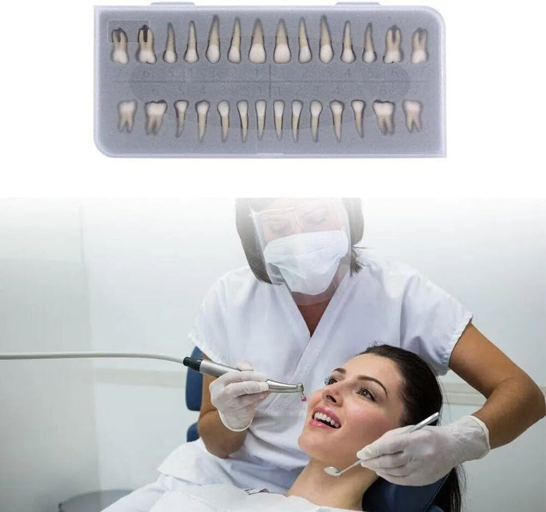 UIGJIOG 28 Modelli Permanenti di Denti Artificiali per Educazione e Ricerca Dentale - immagine 3