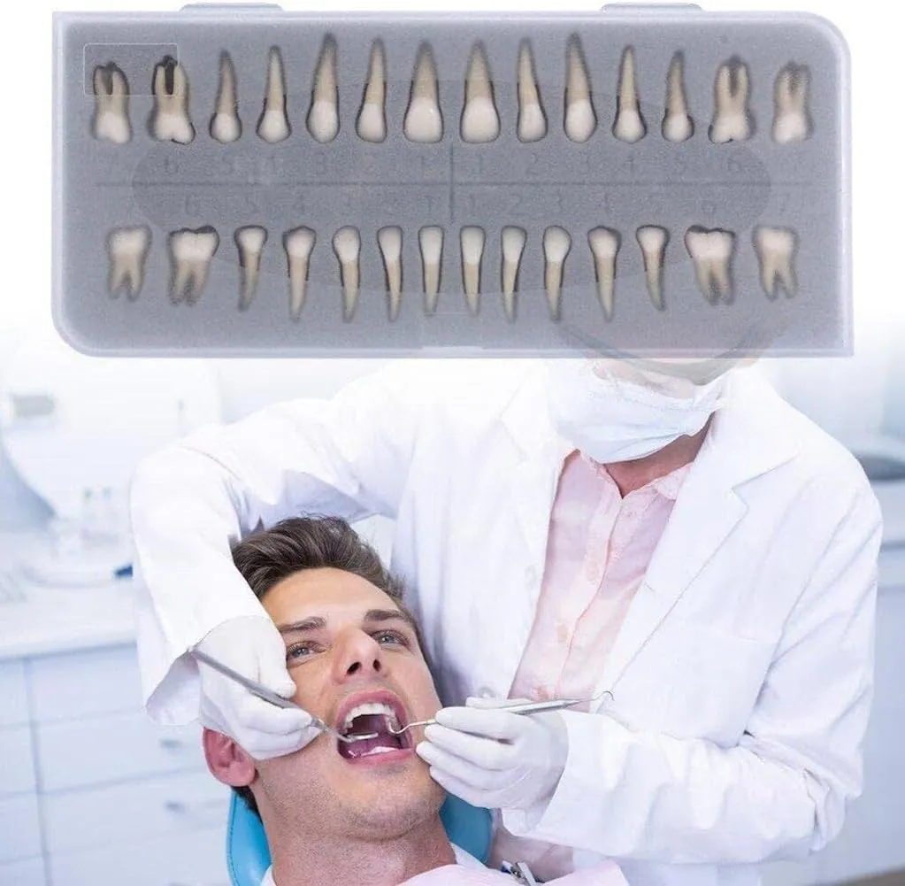 UIGJIOG 28 Modelli Permanenti di Denti Artificiali per Educazione e Ricerca Dentale - immagine 6