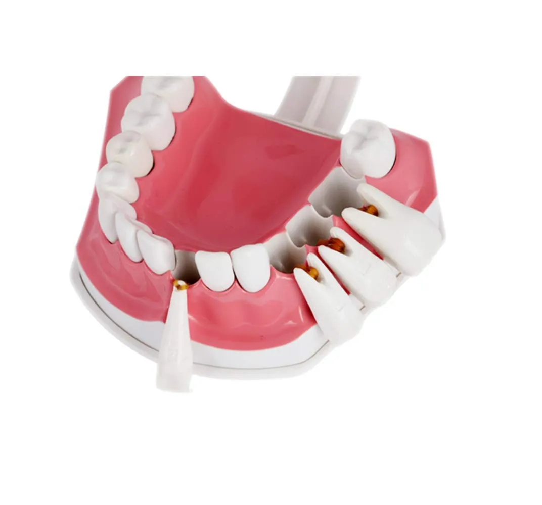 YOUYA DENTAL Modello Dentale di Grandi Dimensioni con Spazzolino e Denti Inferiori Rimovibili per Insegnamento - immagine 5