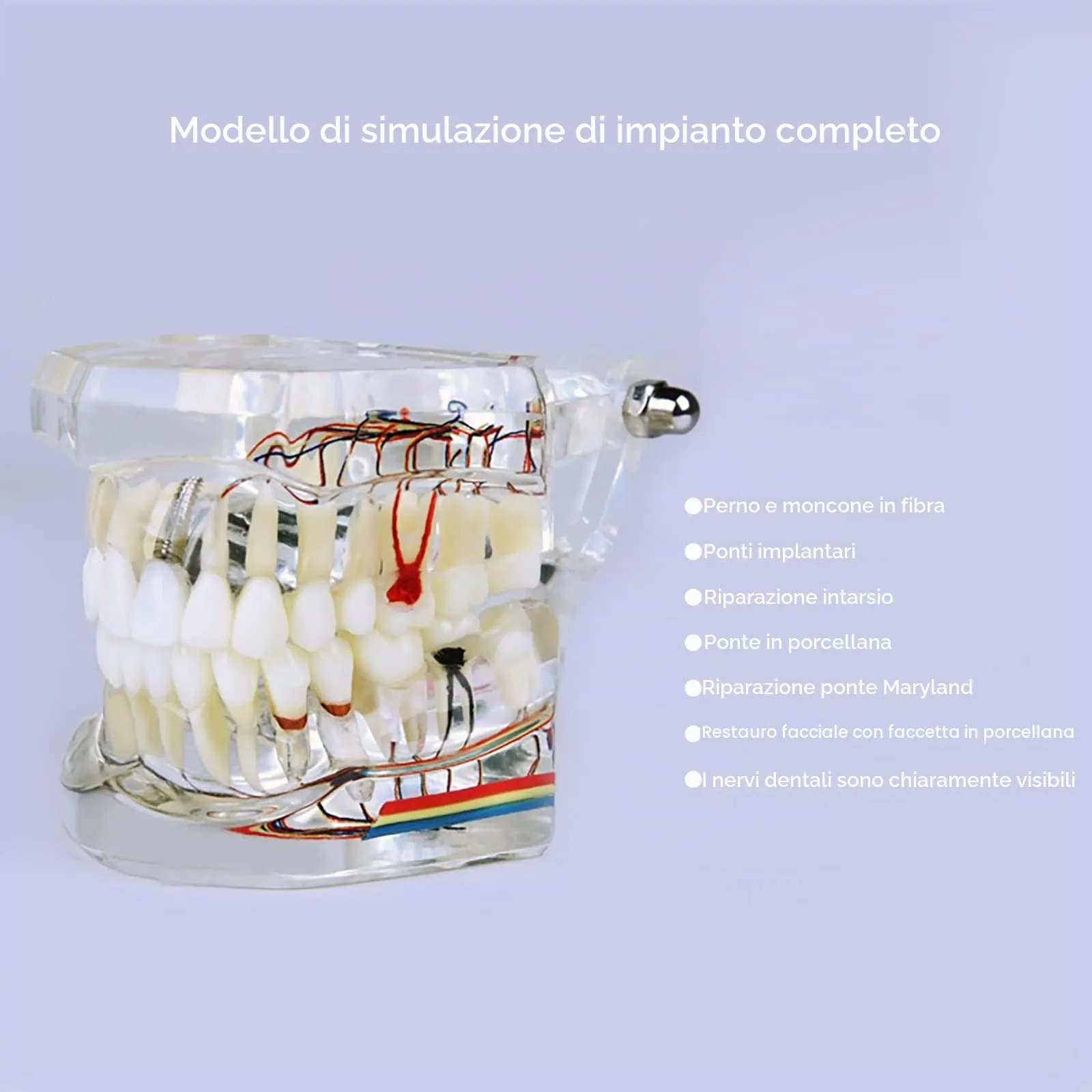 YOUYA DENTAL Modello dentale di riparazione neurale Modello dentale Malattia dell'impianto Modello dei denti Dentista Modello di insegnamento patologico standard dei denti rimovibili - immagine 2
