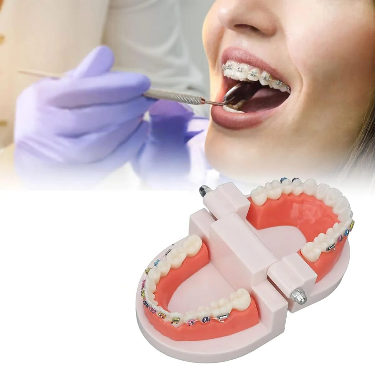 FLNEX Modello Dimostrativo Dentale Typodont con Staffe in Metallo Ortodontico, Modello di Dente Ortodontico per L'insegnamento E La Ricerca del Dentista - immagine 6